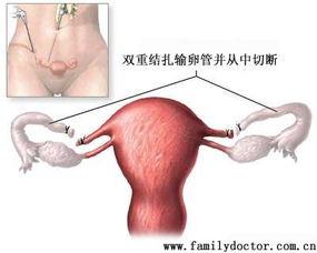 妇科手术视频全过程,从术前准备到术后康复